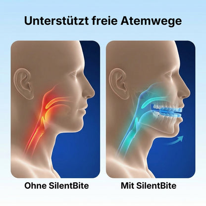 SilentBite Schnarchschiene